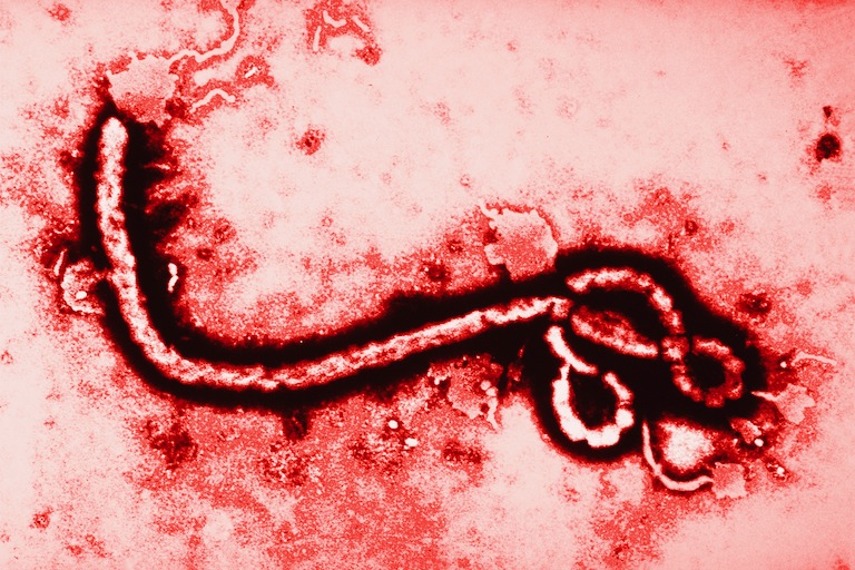 Ebola virus