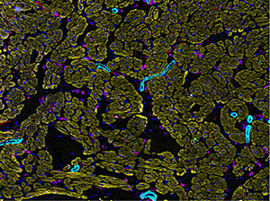 CODEX image of healthy right atrium