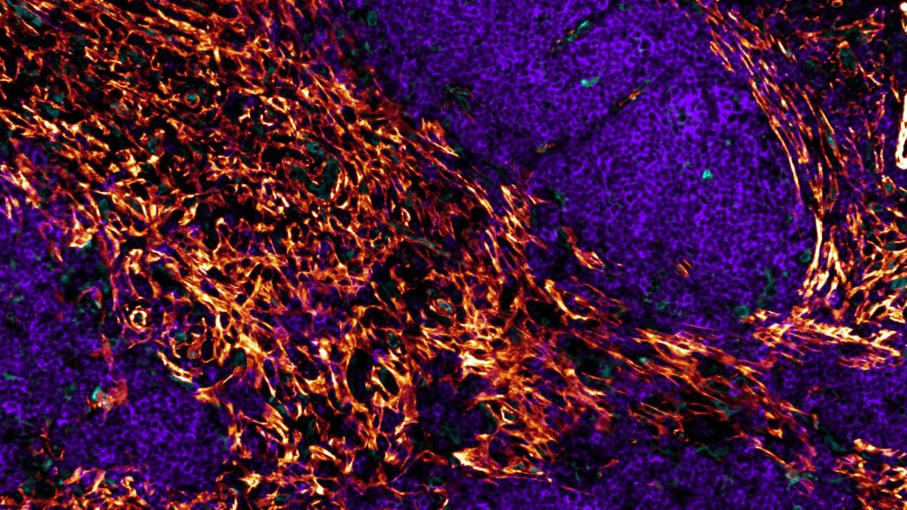 IBEX image of lymph node at cellular level