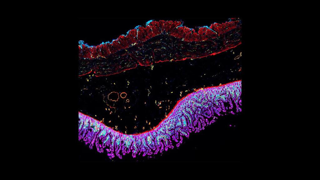 CODEX image of intestine