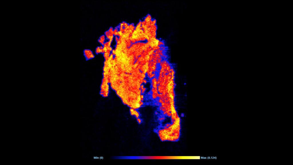 DESI image of the abundance of linoleic acid within the left ventricle