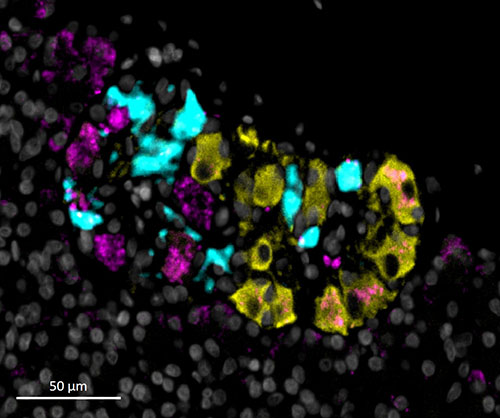 CycIF image of ganglia within the pancreas, courtesy of Sam Ewing at the University of Florida