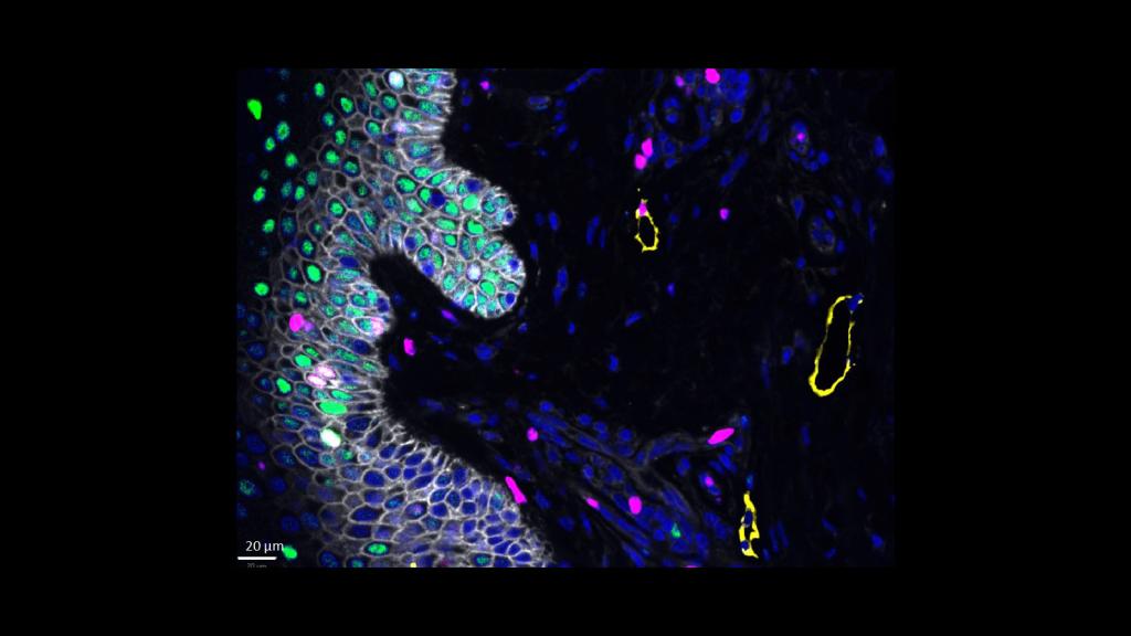 Cell DIVE image of epidermis showing DNA damage from sun exposure