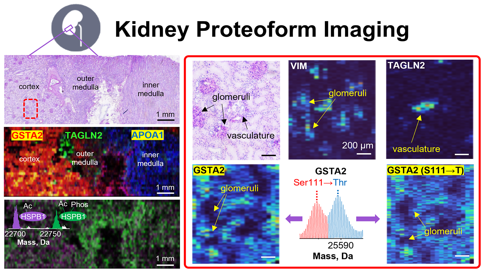 Kidney Proteoform Imaging.