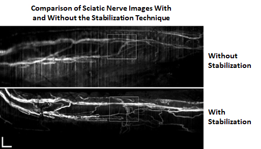 Safety First: Developing Tools and Biomarkers to Prevent Nerve Injury