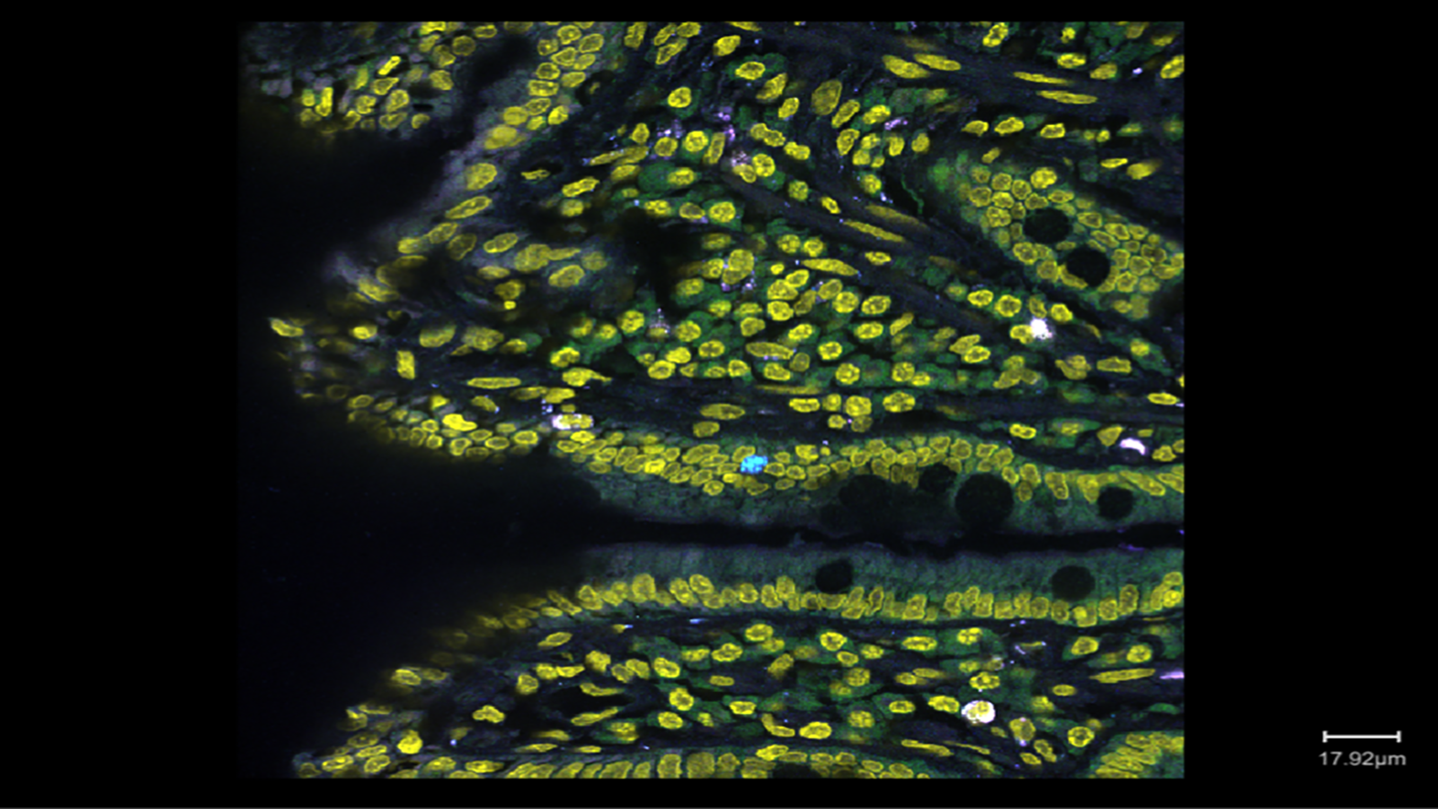 RNA transcripts in a section of healthy human small intestine from Long Cai's lab at Cal Tech