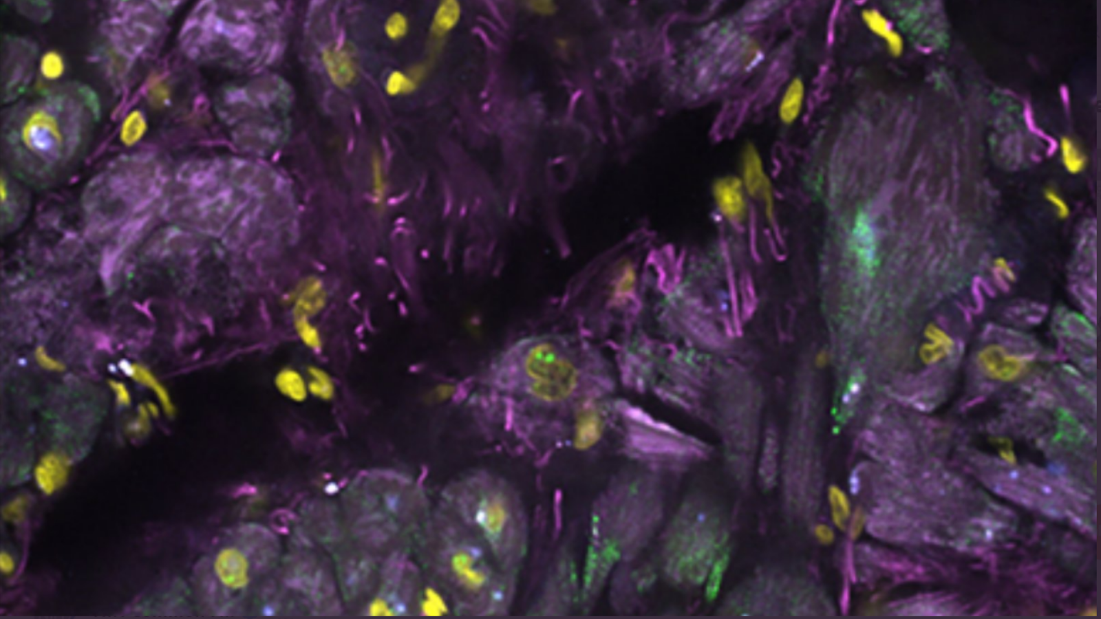 different RNA transcripts in a section of heart tissue, courtesy of Dr. Long Cai at Cal Tech