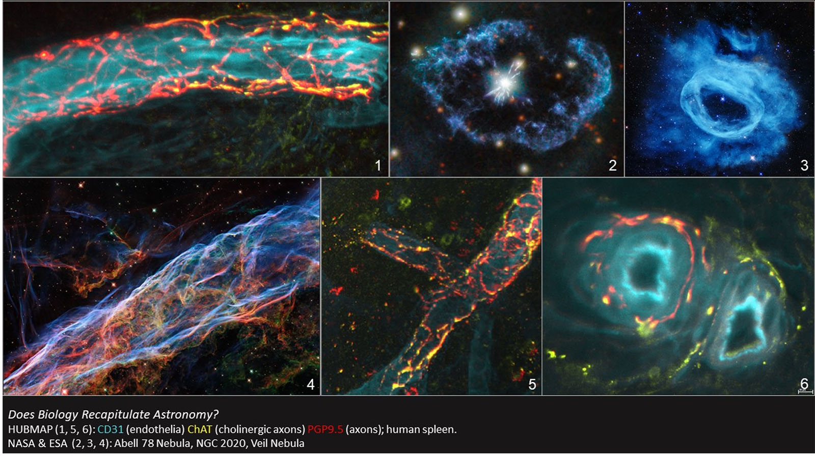 Lightsheet microscopy image of human spleen compared to nebula from Dr. Seth Currlin at University of Florida