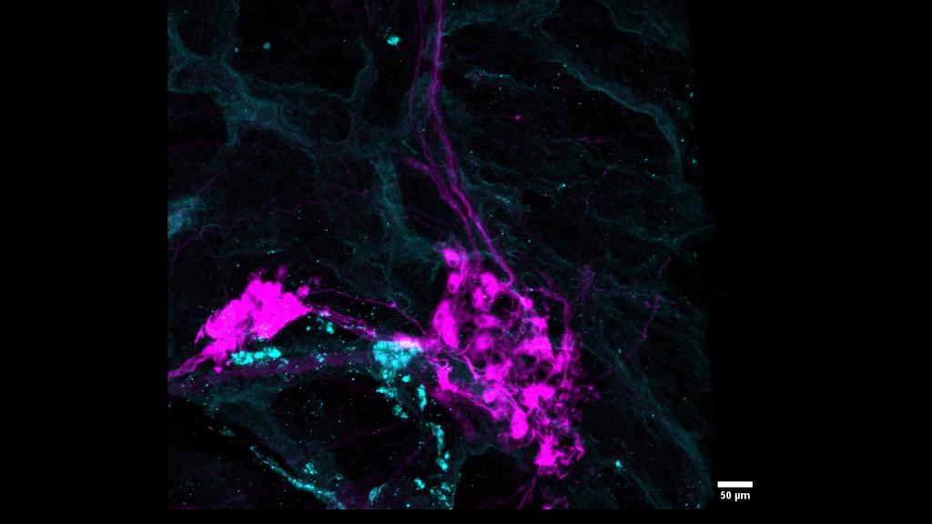 3d microscopy pancreas