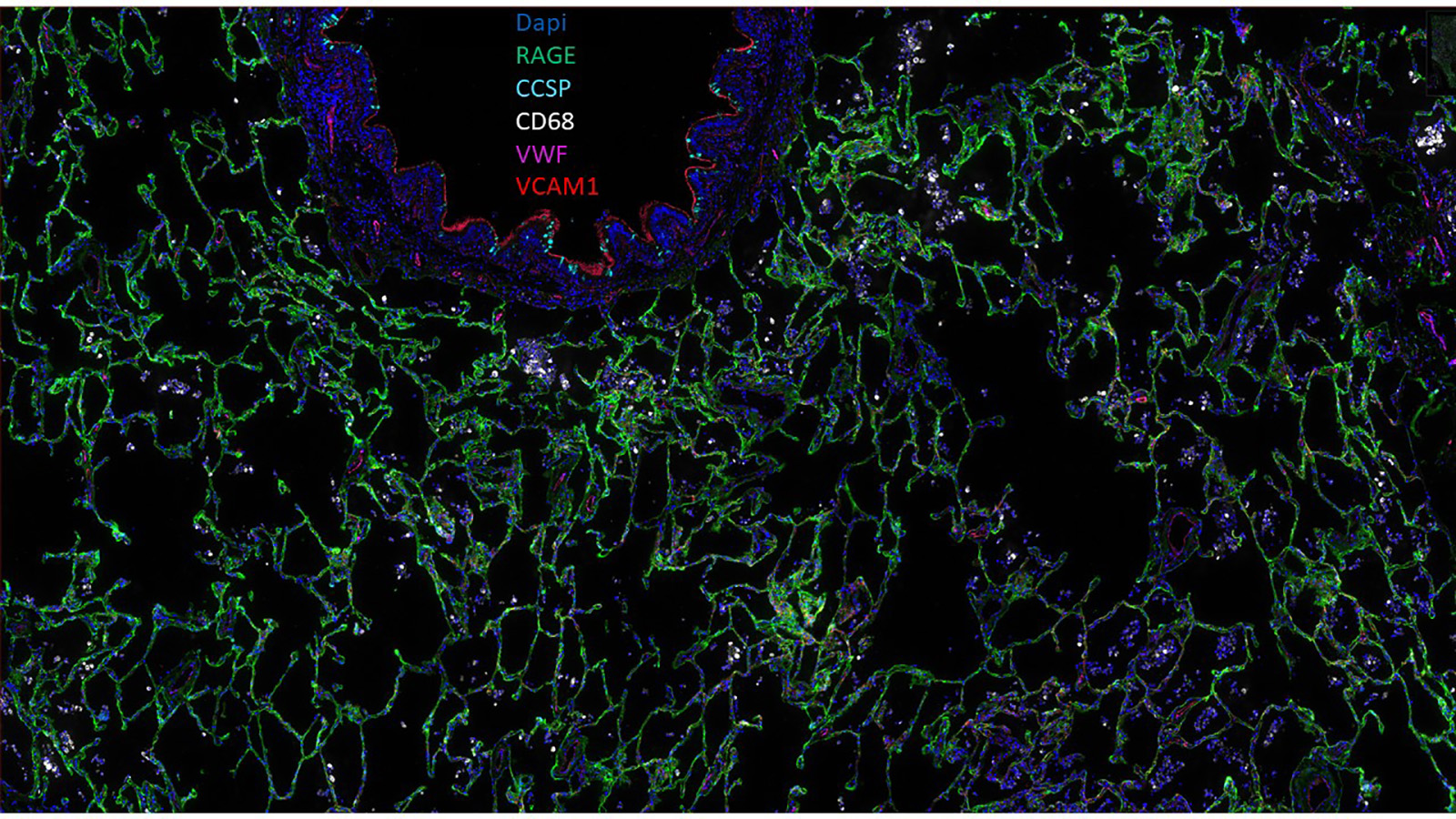 CellDIVE image of healthy human lung courtesy of Gloria Pryhuber, Fiona Ginty, Lisa Lowery, and Christine Surrette