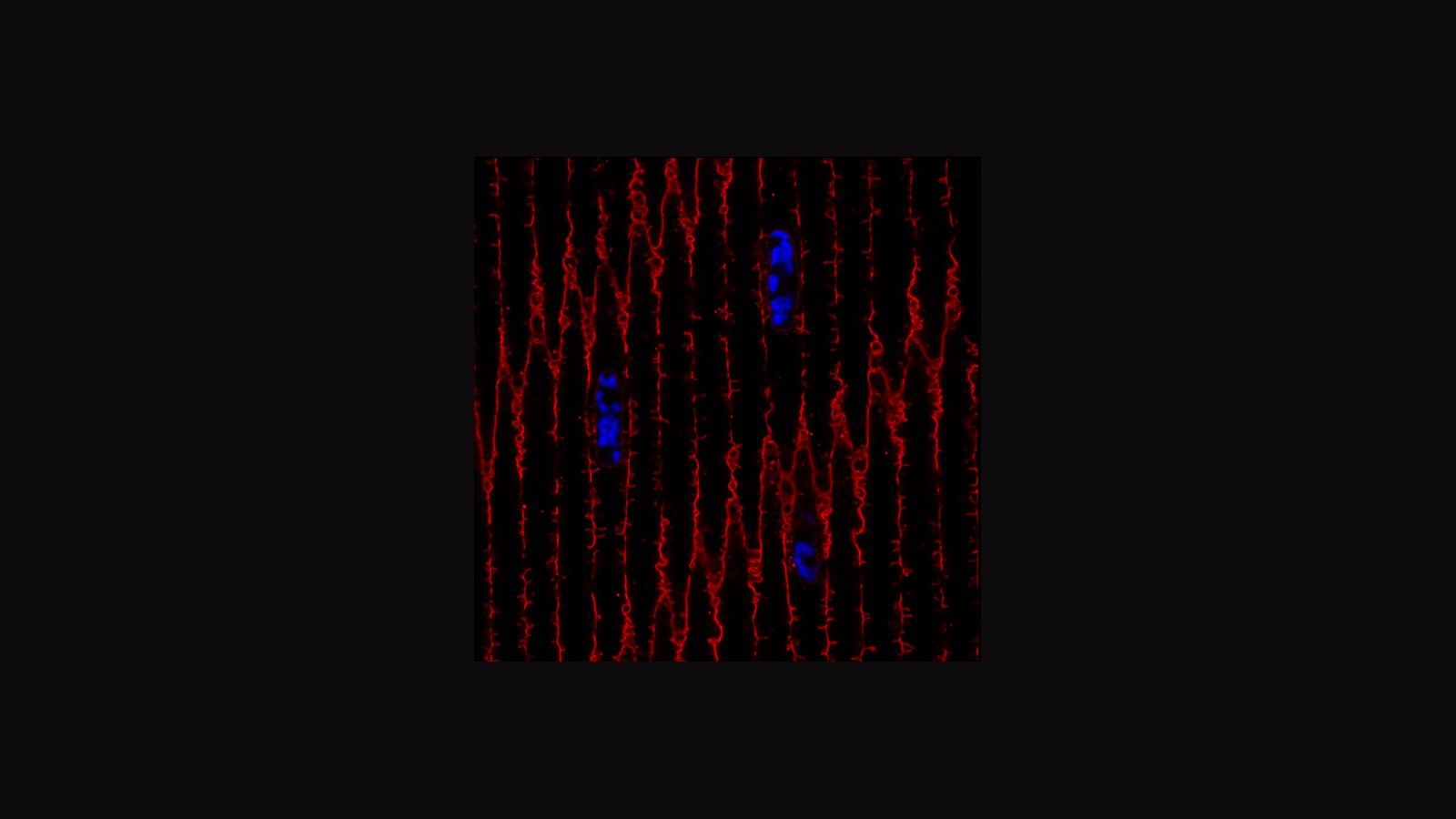 Confocal microscopy image of the human lens courtesy of Angela Kruse