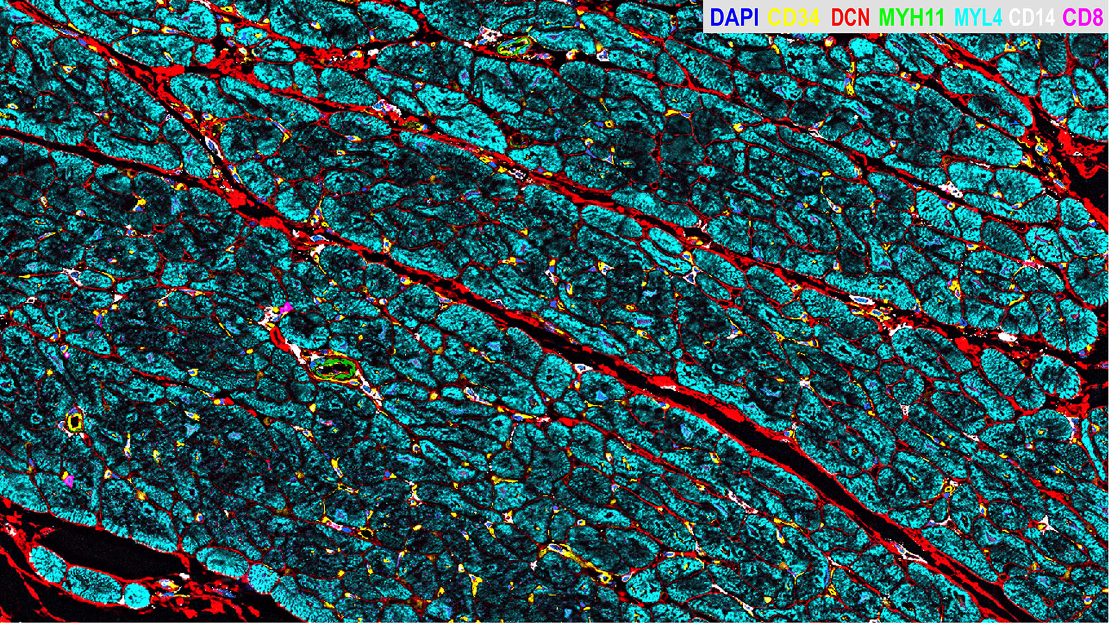 CODEX image of heart ventricles, courtesy of Dr. Kai Tan at CHOP