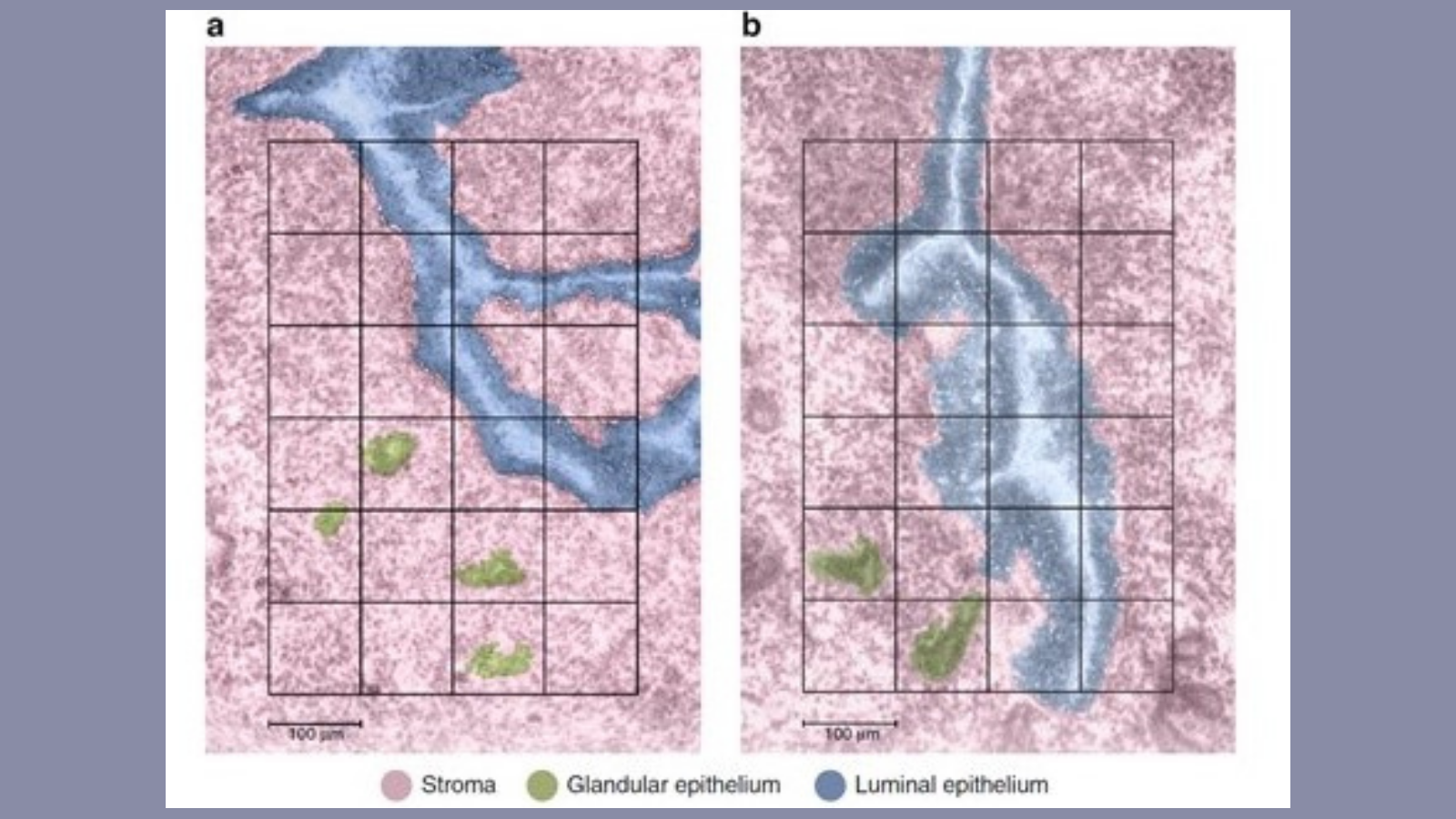 automated mass spectrometry imaging of the proteins in the mouse uterus, courtesy of Dr. Kristin Burnum-Johnson at PNNL