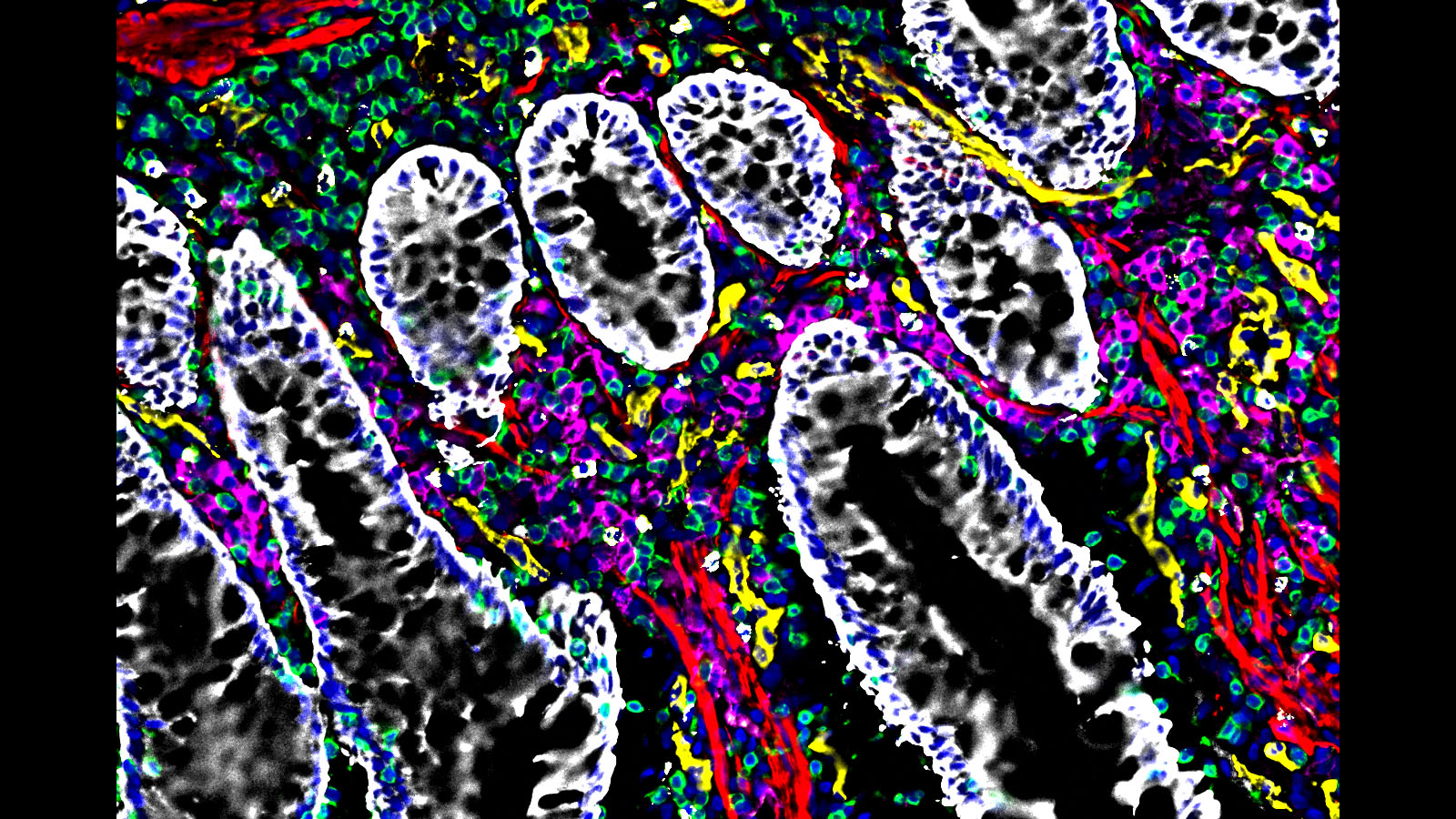 #CODEX image of the intestine courtesy of @stanford researcher Dr. John Hickey