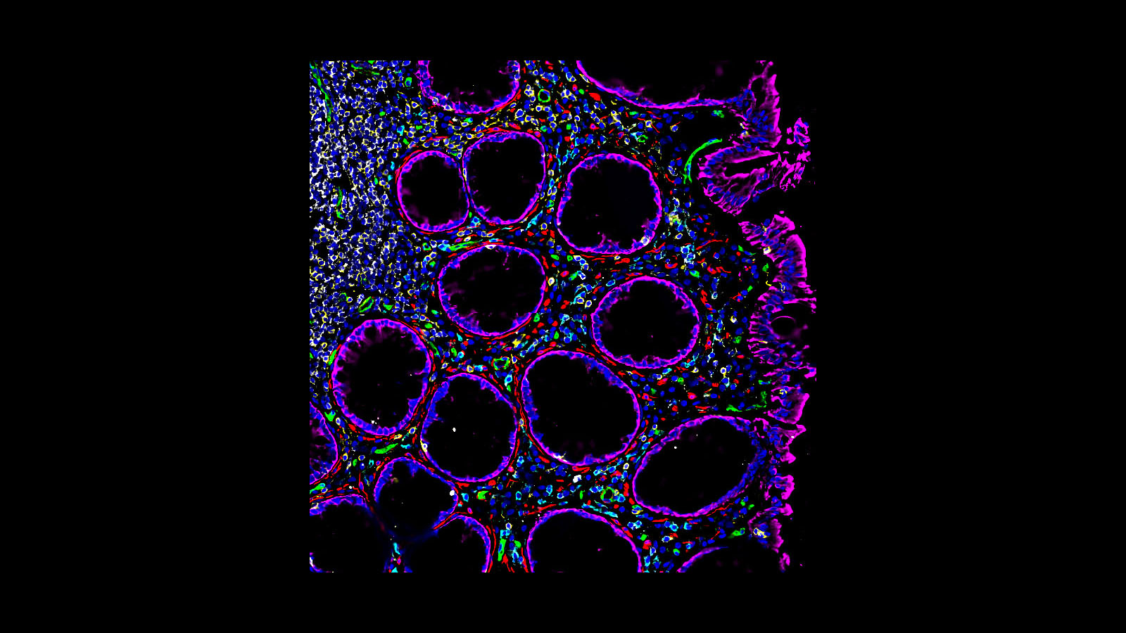 CODEX image of a healthy human colon courtesy of Dr. John Hickey of Garry Nolan's lab at Stanford