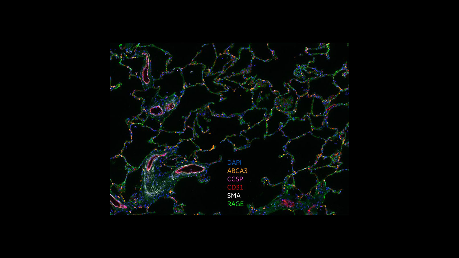 CellDIVE image of alveolar parenchyma cells from GE Research and University of Rochester