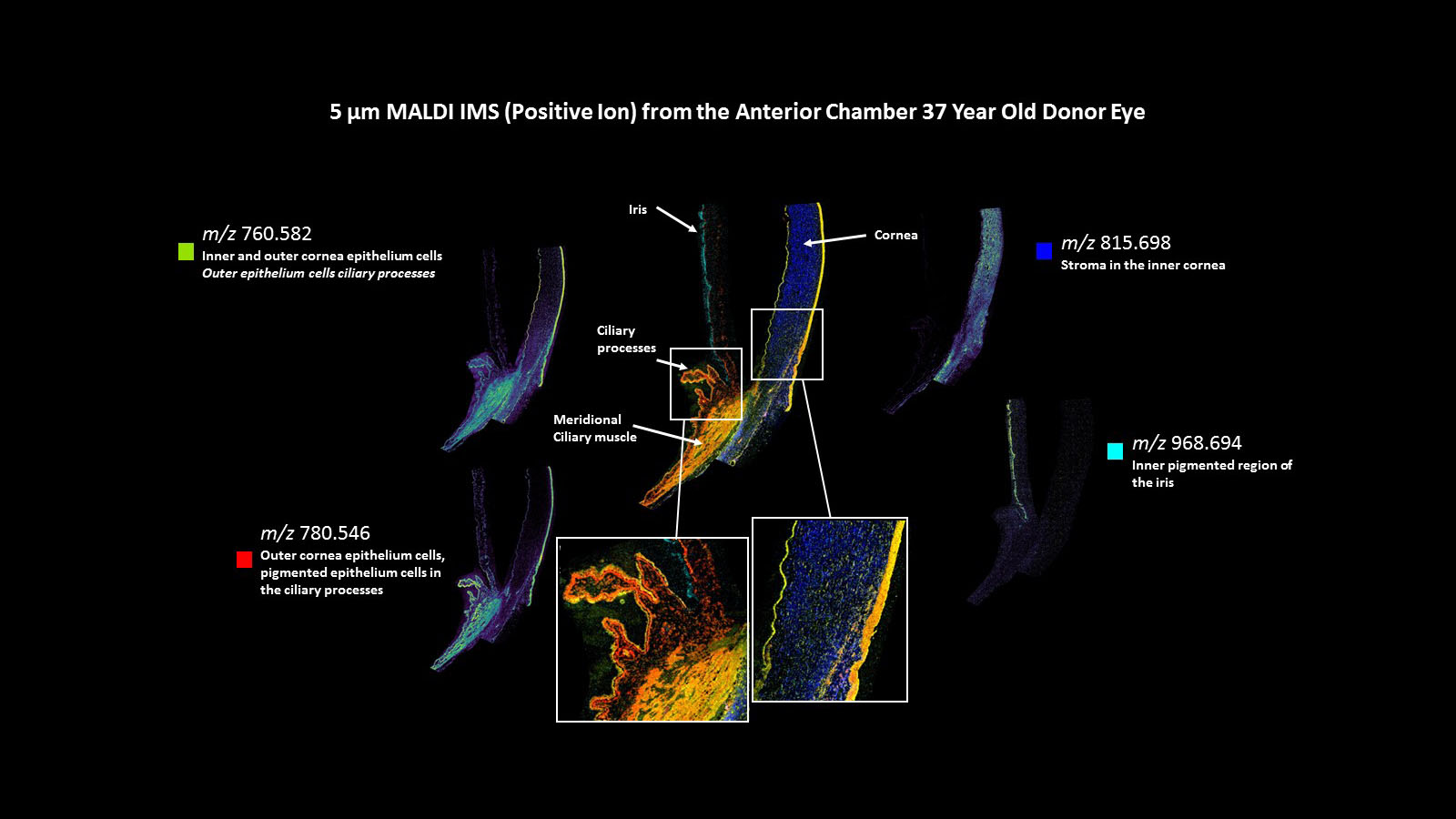 MALDI IMS image of the human cornea, courtesy of Dr. David Anderson from Vanderbilt University