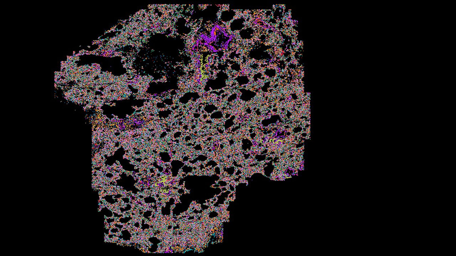 MERFISH image of healthy human lung courtesy of Drs. Quan Shu, Colin Kern, Jamie Verheyden, and Xin Sun at UCSD, and Dr. Gloria Pryhuber at URMC