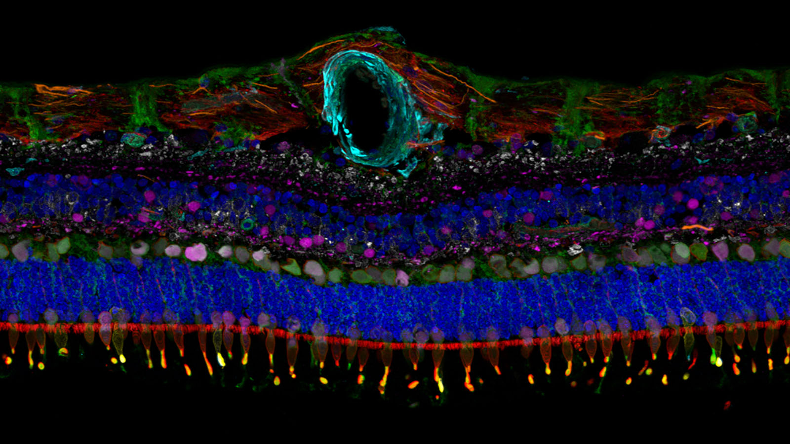 IBEX retina.