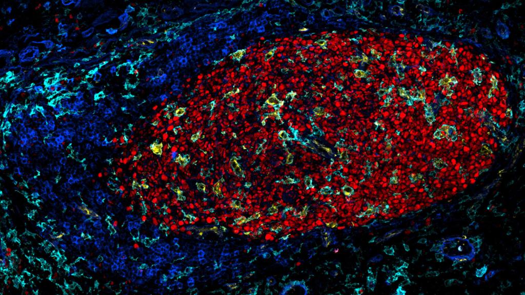 Ibex germinal center of a lymph node.