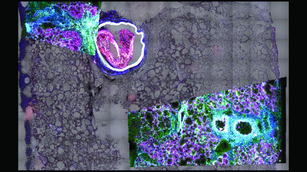 Maldi lung lipids.