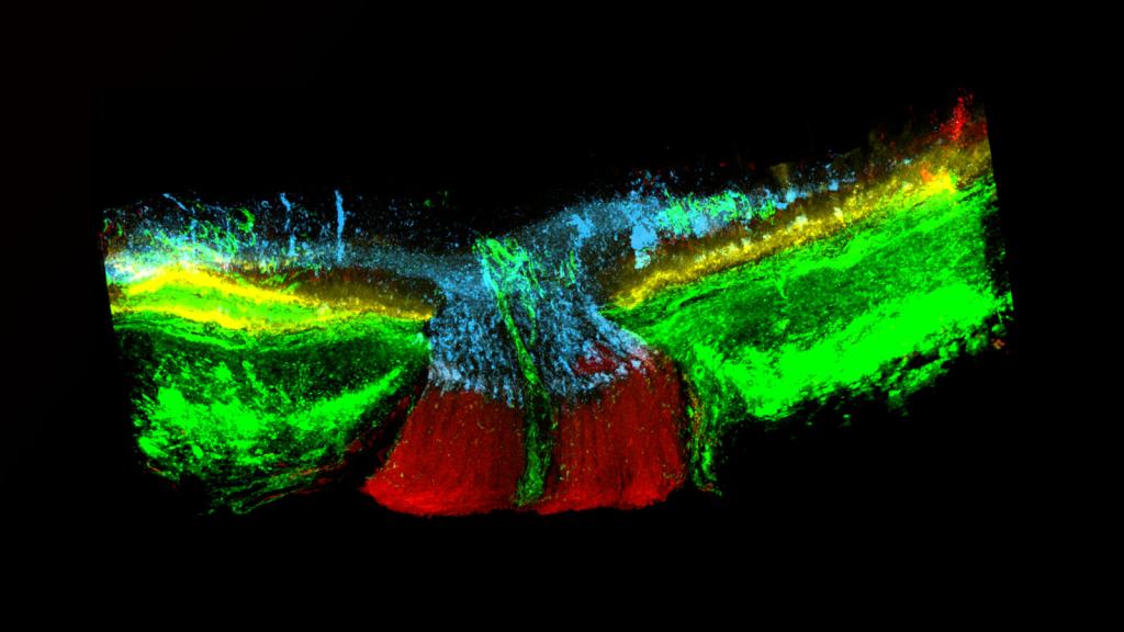 Optic nerve.