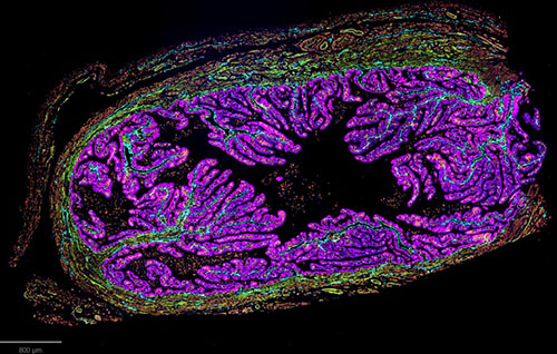 CODEX image of the infundibulum, courtesy of Dr. Kate O'Neill from UPENN