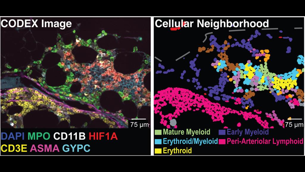 Left panel - CODEX of bone marrow, right panel - visualization of neighborhoods within the bone marrow sample