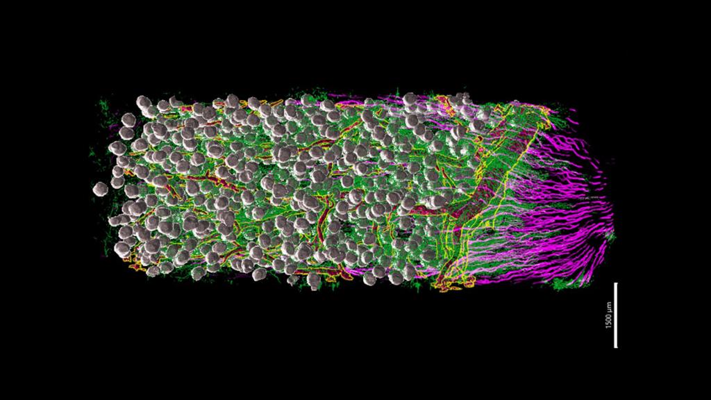 lightsheet microscopy image of fluorescently marked cells in a kidney