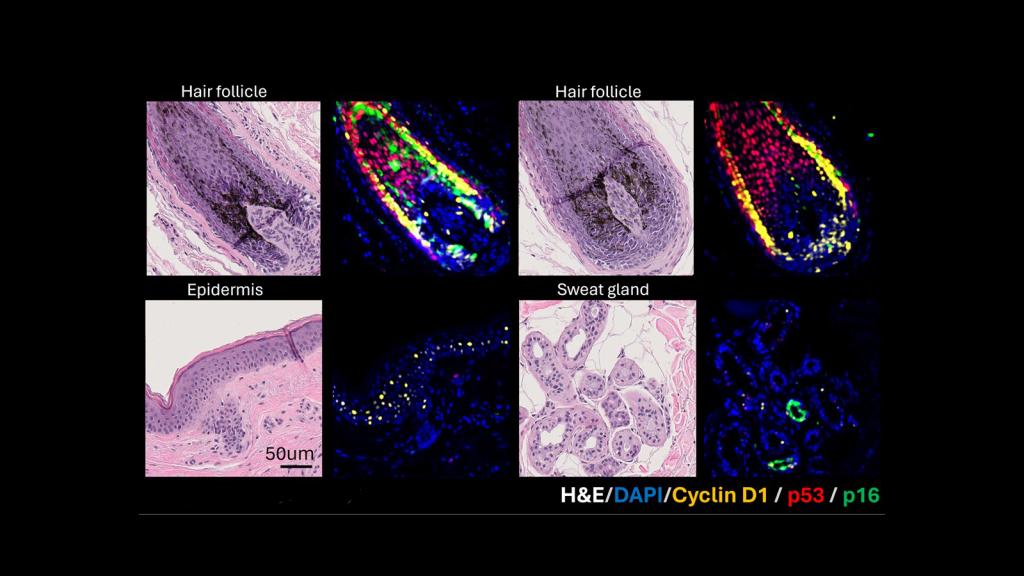 4 images of hair follicle, sweat glands, and epidermis.