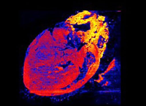 DESI image of the concentration of oleic acid across mouse heart, courtesy of Drs. Liming Pei (CHOP) and Brent Stockwell (Columbia)