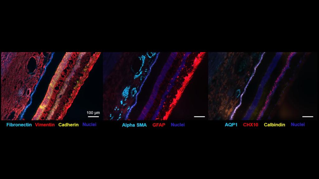 CODEX image of different colored layers representing the retina