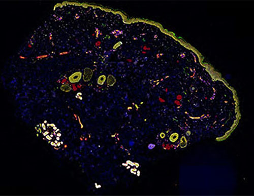 CODEX image of skin, by Dr. Athanasios Ploumakis of the Vlachos lab at Beth Israel Deaconess Medical Center