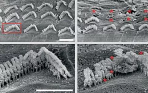 image of hair cells in mouse inner ear before and after administration of a genome editing therapy