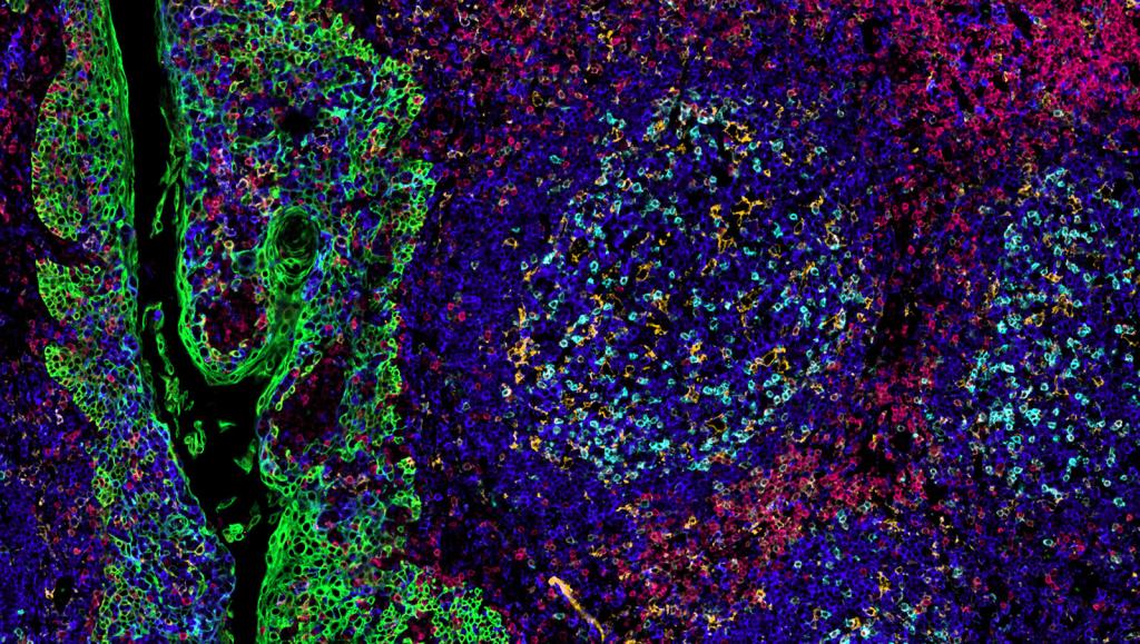 IBEX image of a tonsil, courtesy of Drs. Kartika Padhan and Andrea Radtke in the Germain lab at NIAID