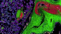 "Organ Mapping Antibody Panel (OMAP) of placenta courtesy of Drs. Santhosh Sivajothi and Ramalakshmi Ramasamy at The Jackson Laboratory"